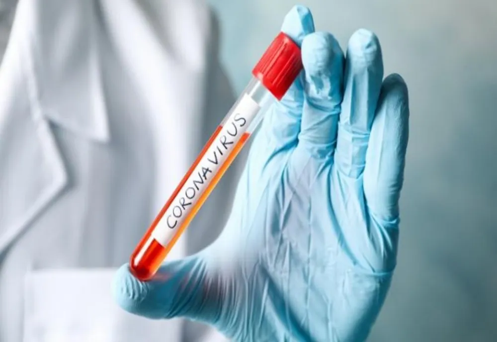 771 de decese provocate de coronavirus