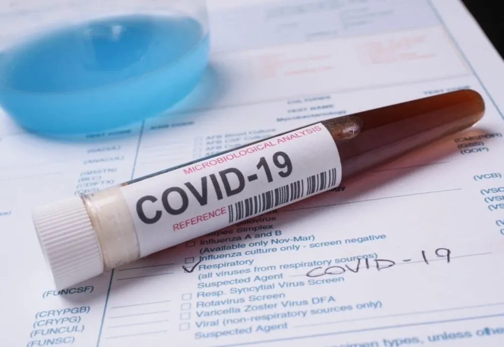 6 cazuri noi de coronavirus în județul Botoșani