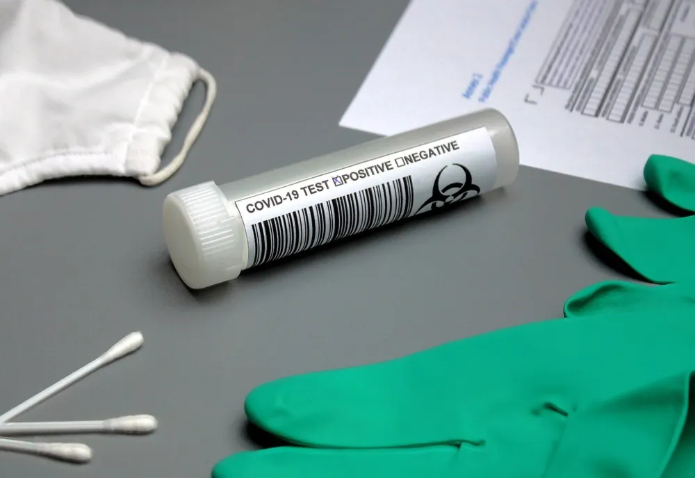 Bilanț coronavirus 27 iulie. Aproape 10.000 de cazuri noi, în ultimele 24 de ore