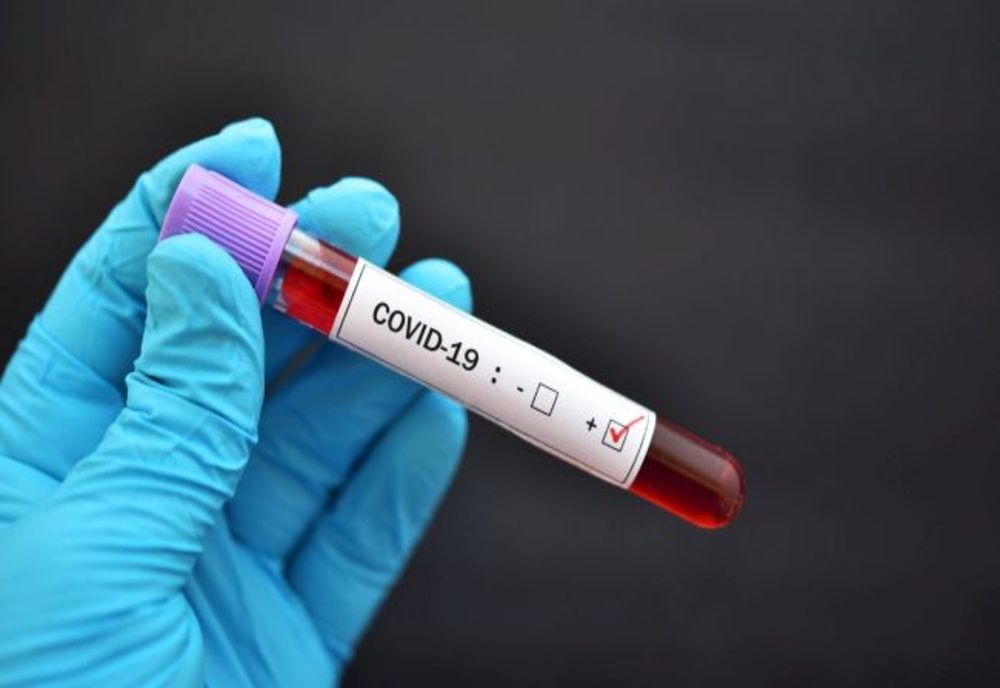 Bilanț coronavirus 21 ianuarie: 2.878 cazuri noi și 69 decese