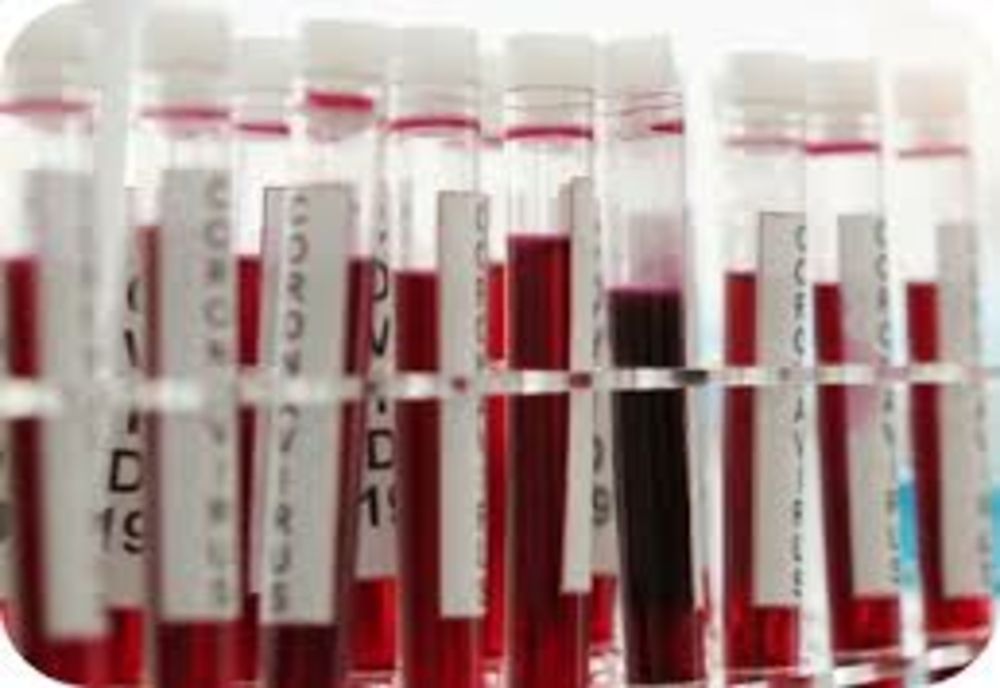 De ce testele de anticorpi nu sunt trecute în certificatul de vaccinare. Explicațiile lui Valeriu Gheorghiță