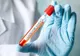 Numărul cazurilor de coronavirus a ajuns la 851, în județul Botoșani