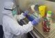 Aparatul de testare COVID va fi amplasat la secția Infecțioase