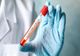 Au încurcat decesele. Asistenta de la Infecțioase nu a murit de COVID