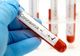 Numărul botoșănenilor infectați cu COVID se apropie de 600