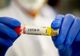 Bilanț coronavirus 22 noiembrie: 1.550 de cazuri noi, 154 decese dintre care 29 anterioare